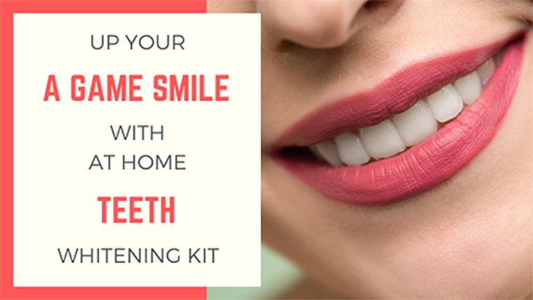 At Home Teeth Whitening feature image